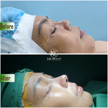 Slider image (6) Dr. Ho Co - Aesthetics and Plastic Surgery in Vietnam